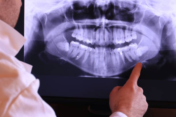 Best Same-Day Emergency Dentist in Wtell, LA