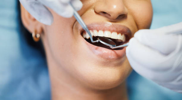 Best Emergency Root Canal Treatment in Wtell, LA