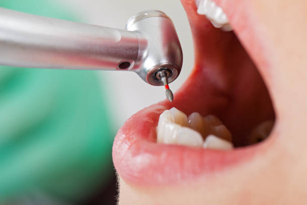 Best Weekend Emergency Dentist in Wtell, LA